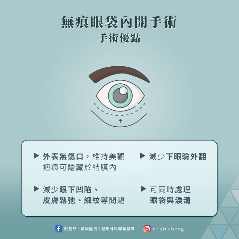 無痕眼袋內開手術 無痕眼待內開手術的優點