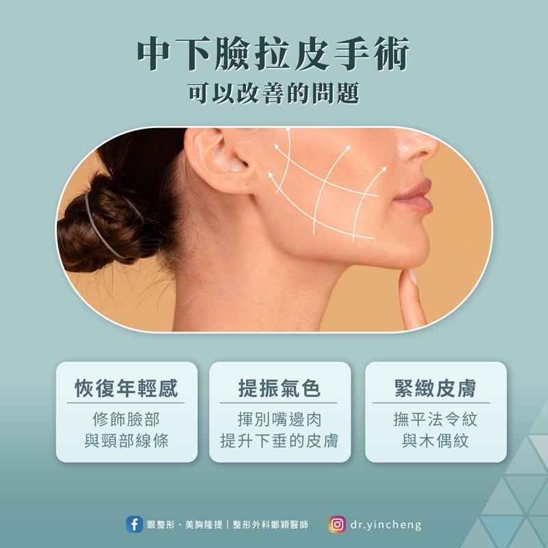 傳統中下臉拉皮手術的原理與特色