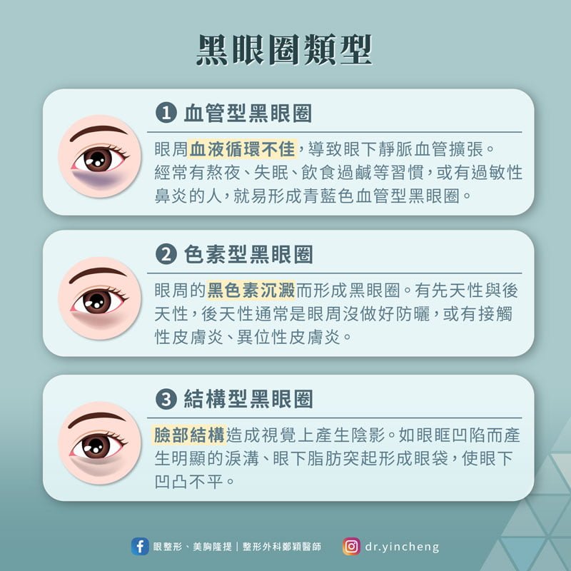 黑眼圈的3種類型